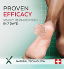 Poderm Very Dry and Damaged Feet Serum 75ml 1535