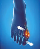 Epitact Hallux Valgus Bunion Corrective Orthesis