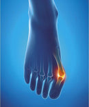 Epitact Protection For Hallux Valgus 1325-S